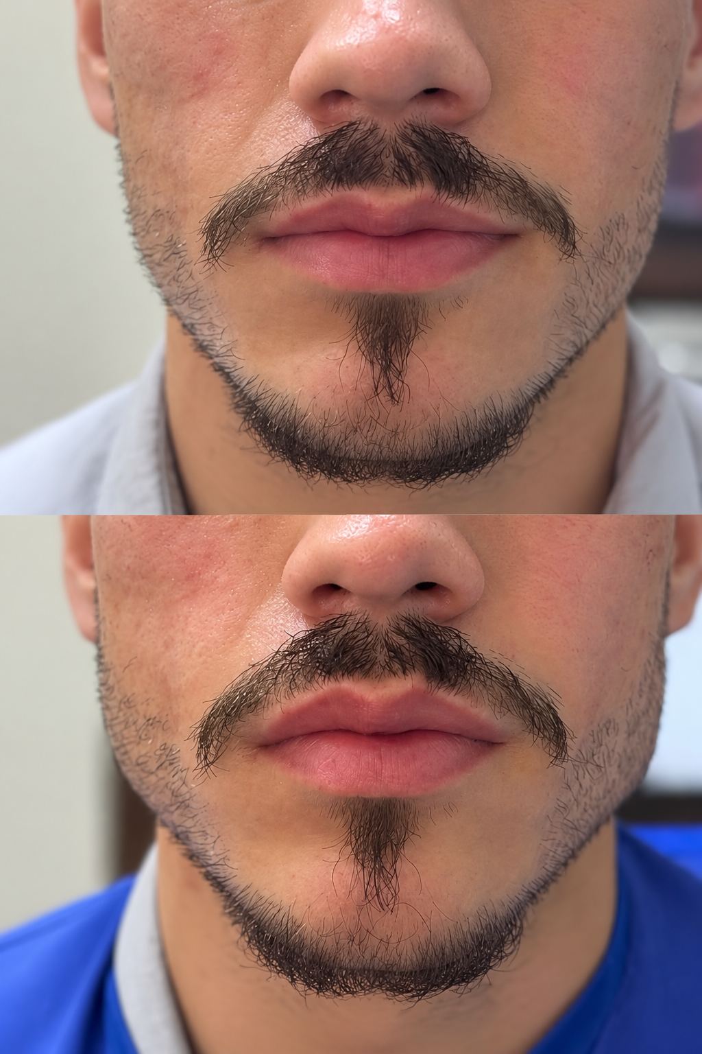Fotografia de antes e depois 7, material fornecido pela New Face